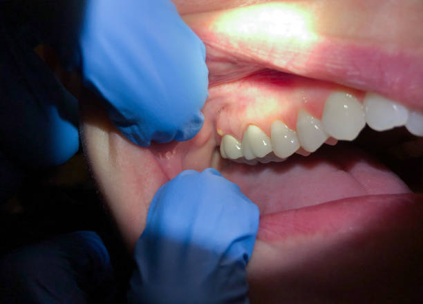 Best Broken Tooth Emergency  in Leechburg, PA