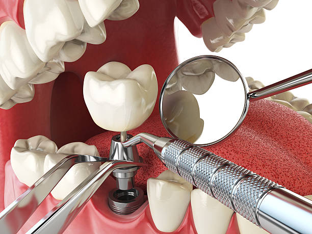 Best Knocked-Out Tooth Emergency  in Leechburg, PA